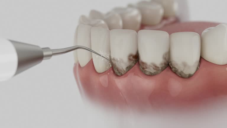 Reliable Dental Implants contractor in Great Bend, NY by Smile Center Dentistry